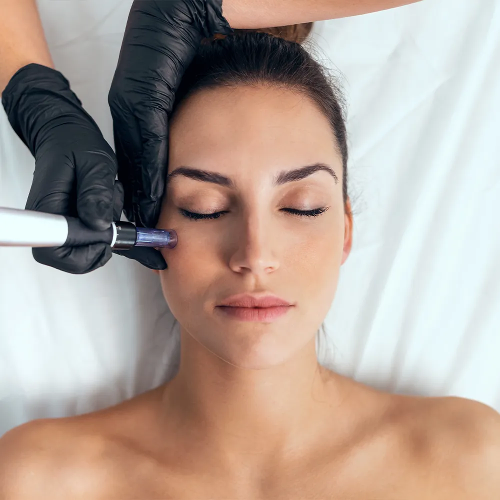 Microneedling